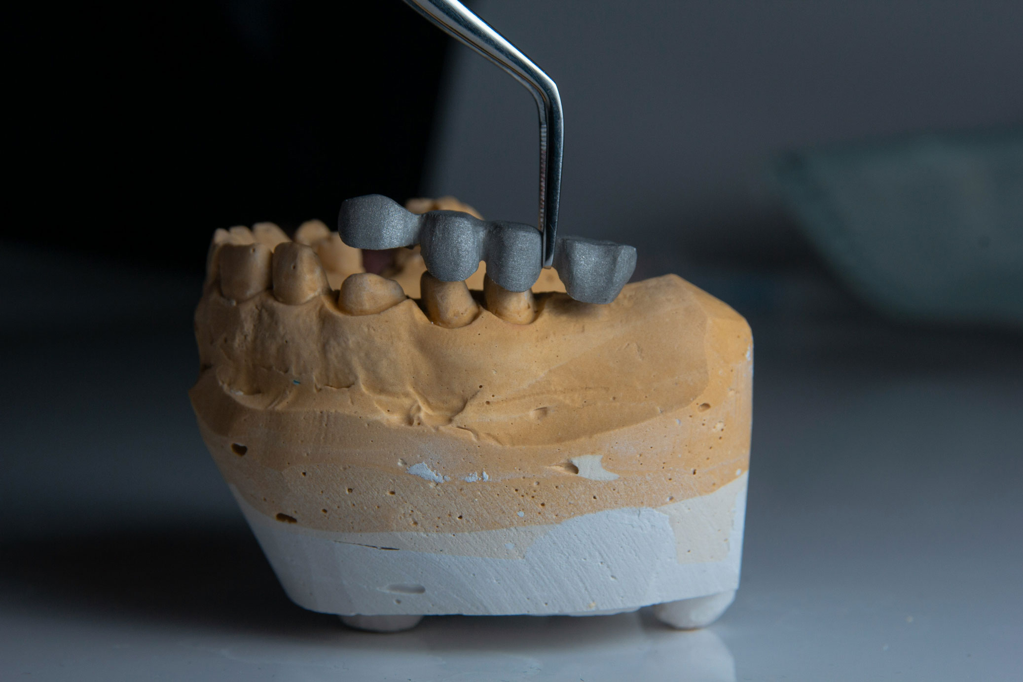 all-on-x-dental